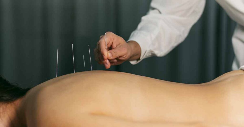 Alívio da depressão com acupuntura: O que você precisa saber