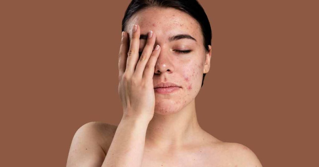 Problemas de pele comuns: O que a dermatologia clínica pode fazer por você