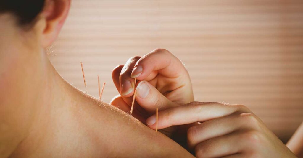 Dor no pescoço como a acupuntura pode oferecer alívio rápido e eficaz