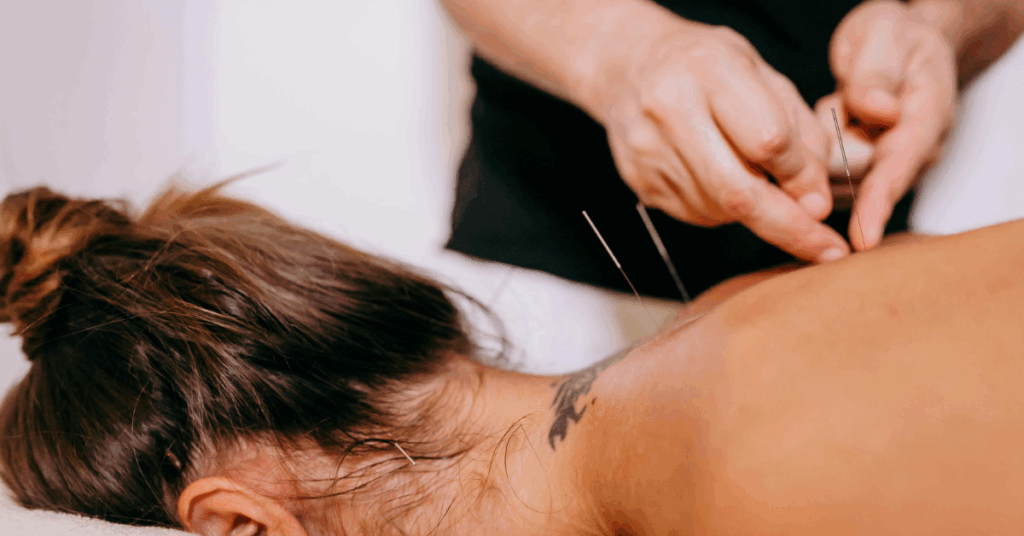 Acupuntura para Fibromialgia - 89% dos Pacientes Melhoram